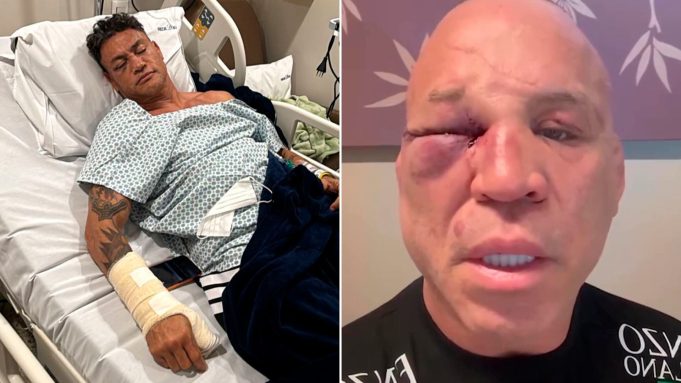 Fracturas, declaraciones cruzadas y polémica: las secuelas que dejó la batalla campal durante una pelea de boxeo en Brasil