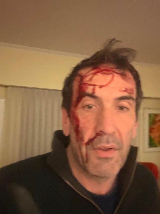 Asaltaron y golpearon al candidato a senador Pablo Cervi: “Le gatillaron varias veces”