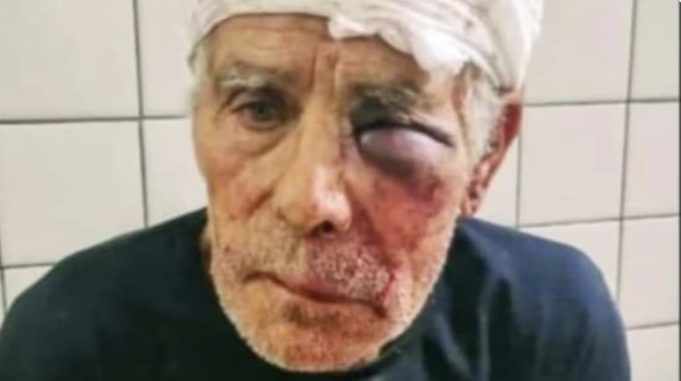 Investigan las causas de la muerte de un reconocido ciclista de Mar del Plata al que golpearon en un robo