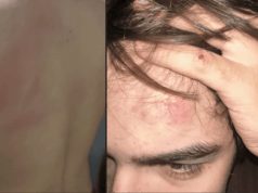 Denuncian a un entrenador de rugby por agredir a un adolescente que intentaba separar una pelea entre perros