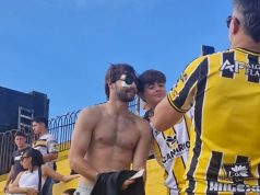 Santiago Sosa mostró cómo quedó su rostro tras la operación por la fractura que sufrió por un golpe de Marcos Rojo