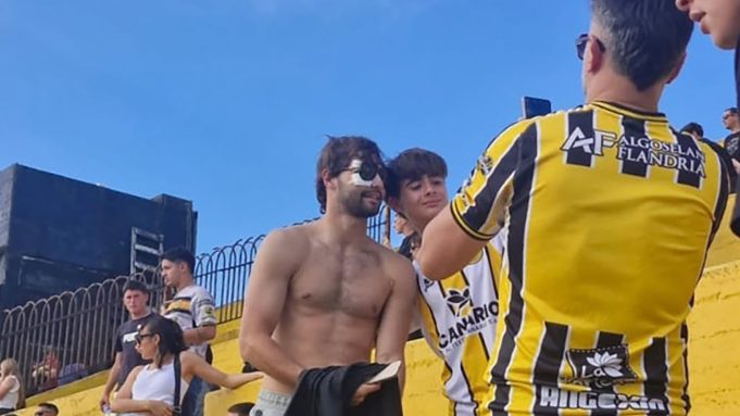 Santiago Sosa mostró cómo quedó su rostro tras la operación por la fractura que sufrió por un golpe de Marcos Rojo